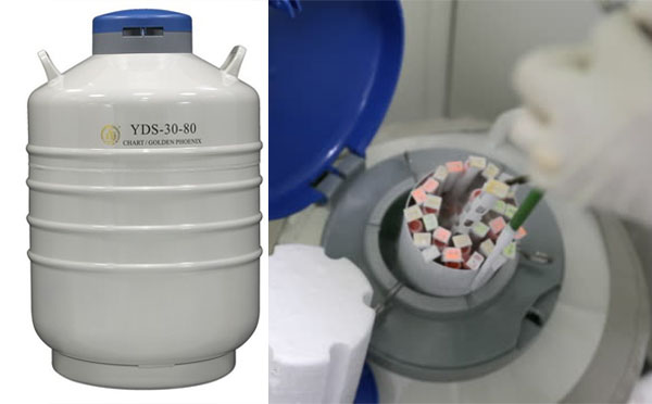 液氮罐管理 液氮罐管理